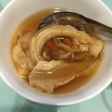 刚做完流产手术可以吃鱼胶吗（做完无痛人流需要注意什么）