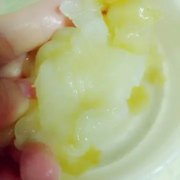肠癌手术后吃鱼胶(肠癌病人术后可以吃什么食物？)