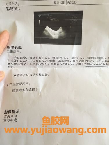 鱼胶可以消除宫腔积液积液吗(怀孕初期宫腔积液吃什么能消除积液)