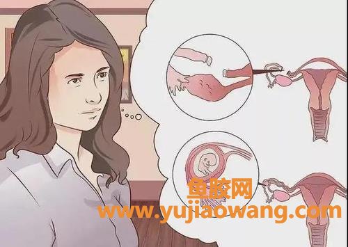 生化妊娠跟流产的区别(生化妊娠流产和自然流产的区别)