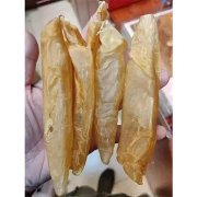 子宫肌瘤可以吃鱼胶吗(子宫肌瘤开腹手术后恢复中可以吃鱼胶吗