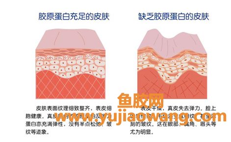 (喝鳕鱼胶原蛋白肽有什么作用)孕妇妈妈究竟该不该补充胶原蛋白_