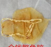 结肠炎能吃花胶吗(结肠炎吃什么能好？)