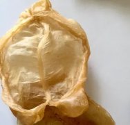 吃花胶会胎盘 胎盘低可以吃花胶吗