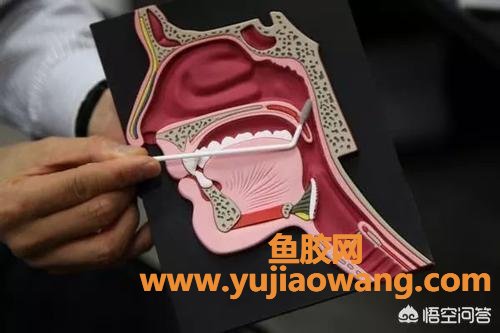 咽喉炎的治疗方法 咽喉炎最佳治疗土方法 咽喉炎的治疗方法 咽喉炎最佳治疗土方法