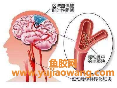 头昏的原因 引起头晕的十大常见原因 头昏的原因 引起头晕的十大常见原因