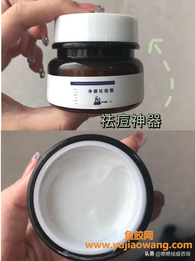 痘痘是什么引起的 脸上长痘是什么引起的 痘痘是什么引起的 脸上长痘是什么引起的