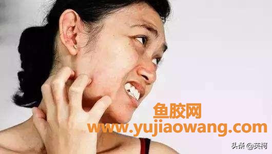 脸上痒怎么办 脸上痒怎么办可以擦什么 脸上痒怎么办 脸上痒怎么办可以擦什么