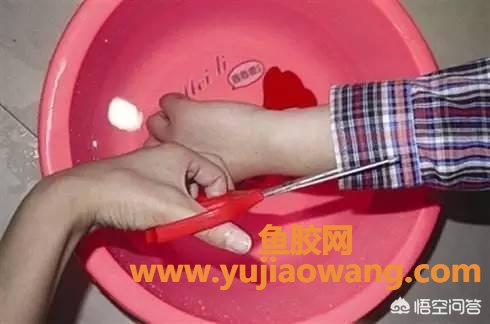 小孩烫伤怎么办 小孩烫伤起泡了怎么处理 小孩烫伤怎么办 小孩烫伤起泡了怎么处理